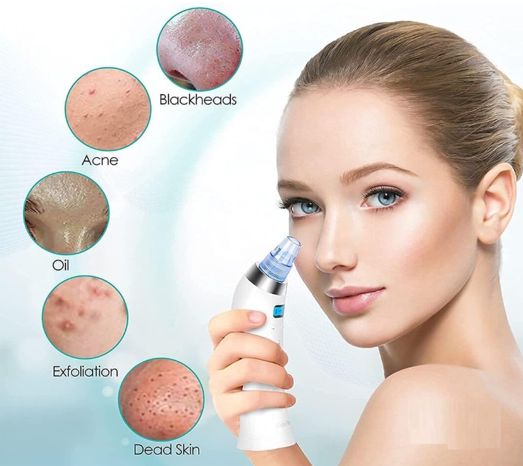 4-in-1 Pore Vacuum Cleaner – Deep Cleanse, Exfoliate & Glow Instantly