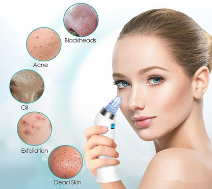 4-in-1 Pore Vacuum Cleaner – Deep Cleanse, Exfoliate & Glow Instantly