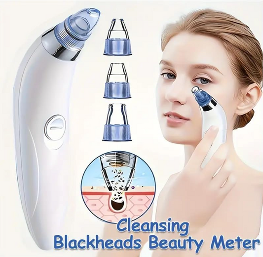 4-in-1 Pore Vacuum Cleaner – Deep Cleanse, Exfoliate & Glow Instantly
